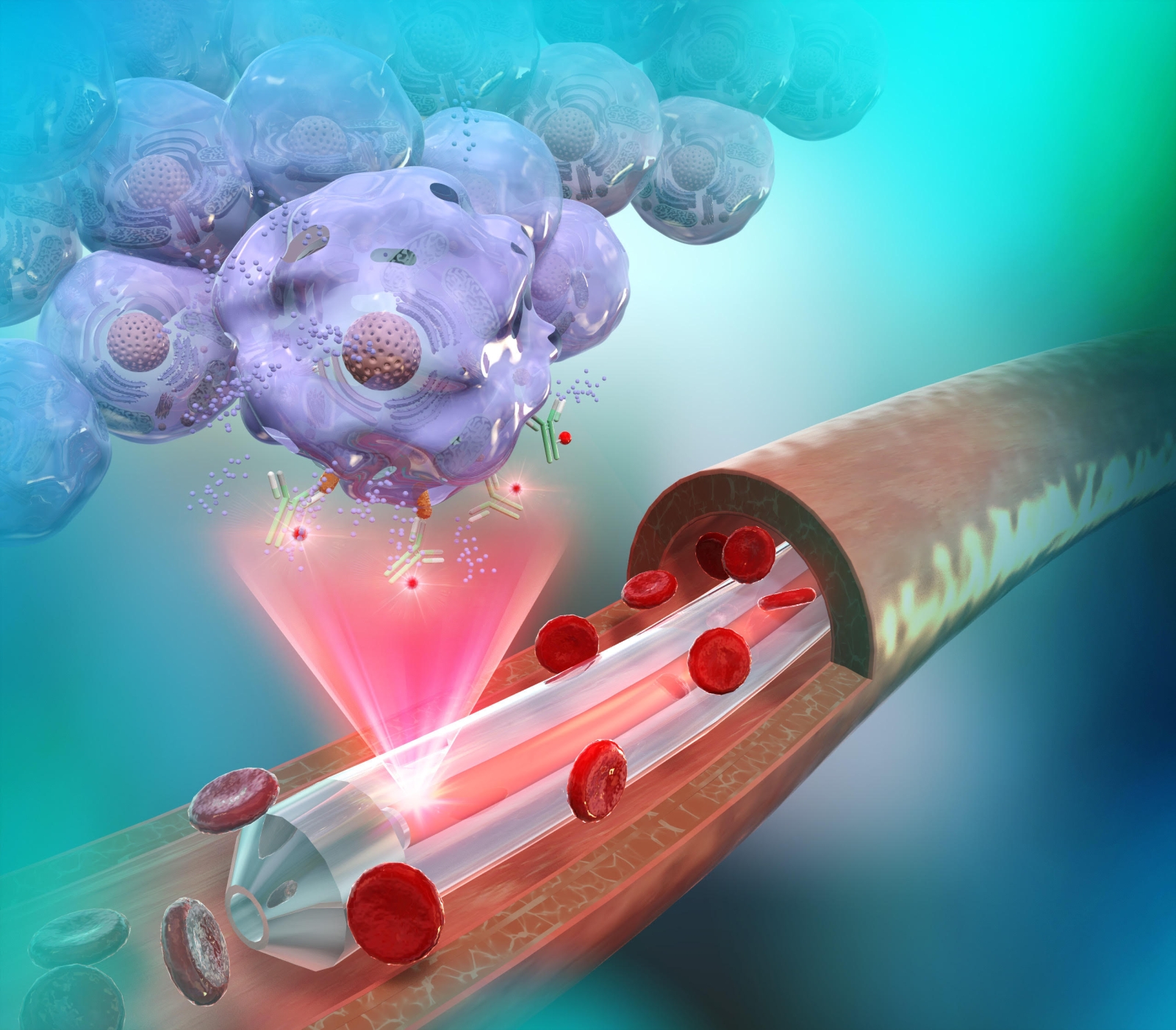 腫瘍に集積した薬剤に対して血管内から光を照射する概念イメージ図